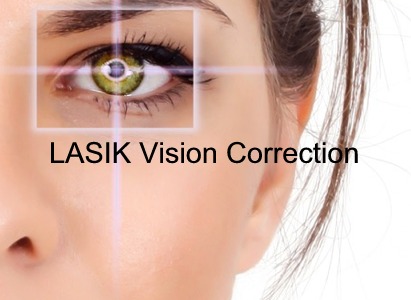 LASIK Vision Correction